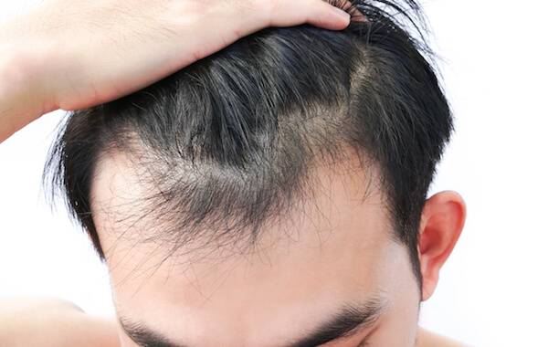 داروهای موثر برای مقابله با ریزش مو: راهنمایی برای بازیابی سلامت مو